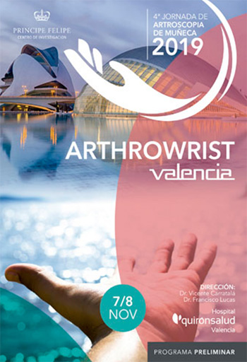 artroscopia de muñeca