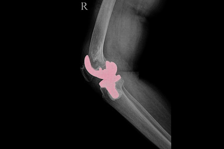 traumaunit unidad septicos
