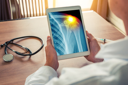 manguito de los rotadores