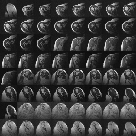 Traumaunit y patologia hombro