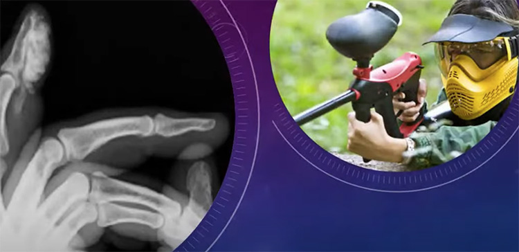 Traumaunit cirugia de mano