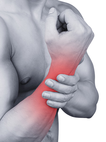 sindrome tunel carpiano