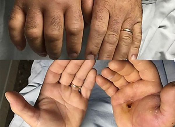 traumaunit cirugia de la mano