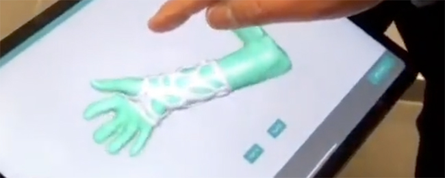 Traumaunit fracturas