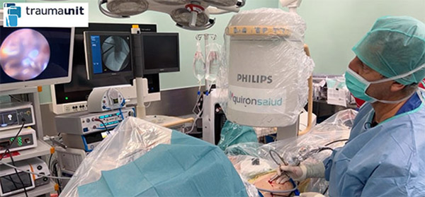 artroscopia de cadera