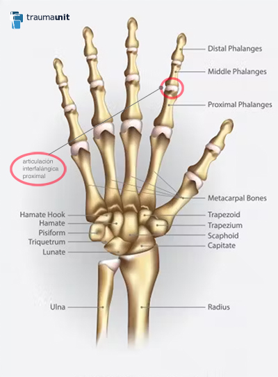 articulacion-interfalangica-proximal