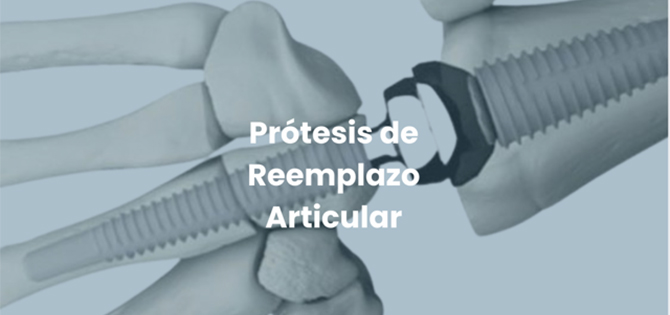 protesis de reemplazo articular