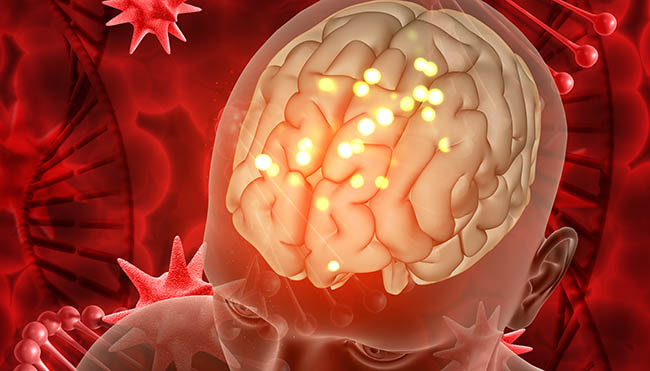 ictus y neurorrehabilitacion